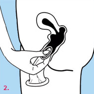 Load image into Gallery viewer, Femidom 3 Pk