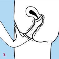 Load image into Gallery viewer, Femidom 3 Pk